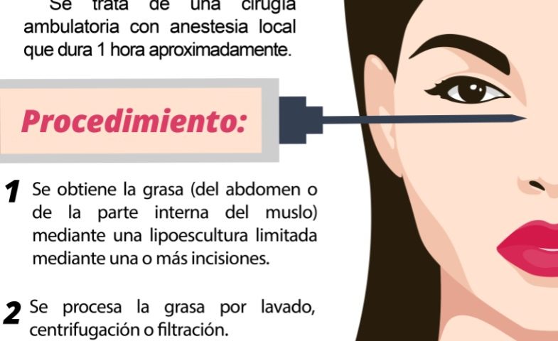 procedimiento de lipotransferencia en Madrid - Dr. Sarmentero