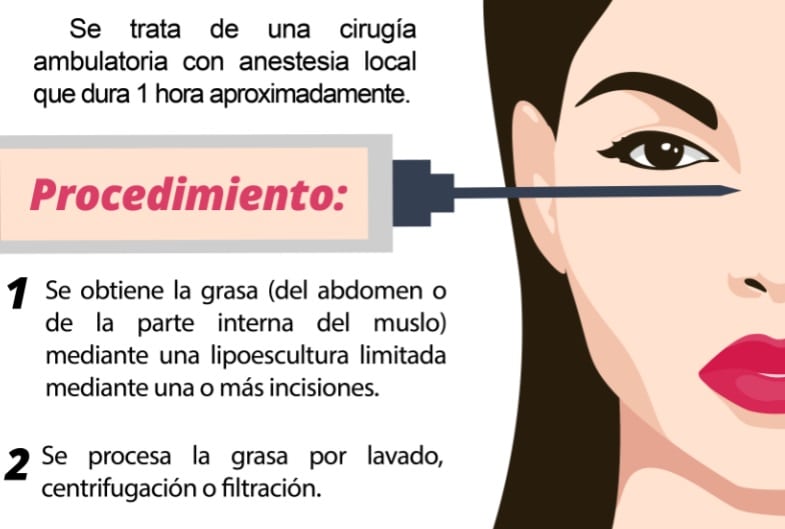 procedimiento de lipotransferencia en Madrid - Dr. Sarmentero