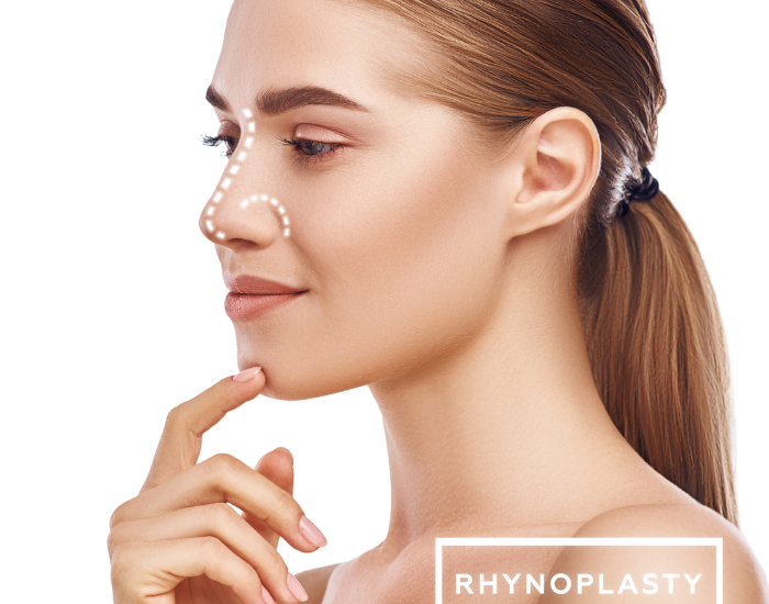 imagen de operacion de nariz rinoplastia madrid